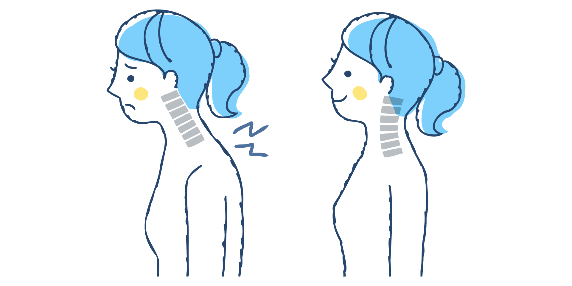 首矯正のイメージイラスト